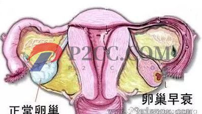 女人做了試管嬰兒人就廢了？好可怕，真的嗎？(圖2)
