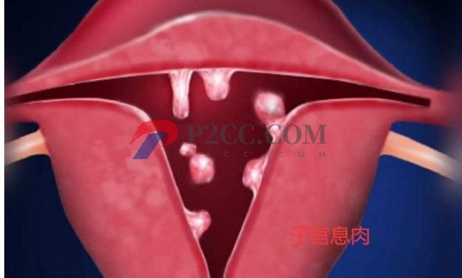 排卵期性腹痛和出血是怎么回事，需不需要治療？(圖2)