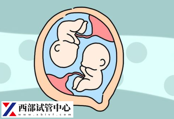 雙胞胎流產的風險略高于單胎