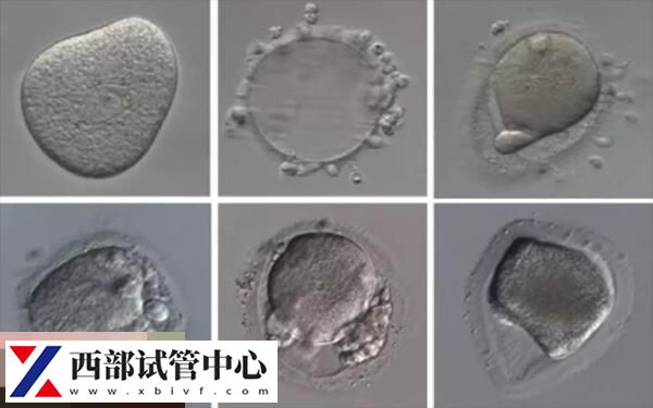 3個(gè)囊胚篩選<a href=https://www.nzzt.cn/topic/92.html target=_blank class=infotextkey>成功率</a>大概在40%-45%左右