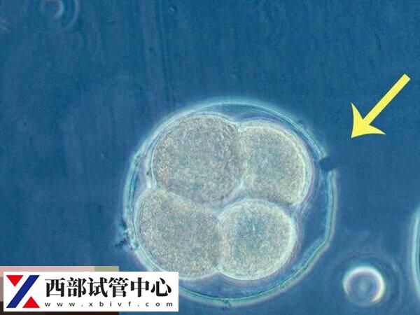 胚胎冷凍技術是輔助生殖技術的衍生技術